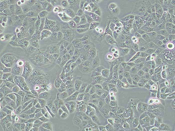 HEC-1-A人子宫内膜腺癌细胞（STR鉴定正确）