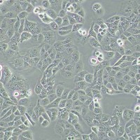 HEC-1-A人子宫内膜腺癌细胞（STR鉴定正确）