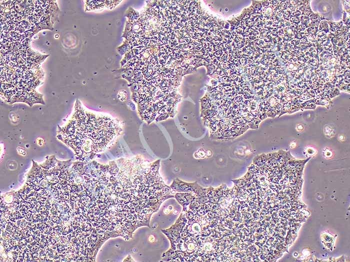 BT-474人乳腺导管癌细胞（STR鉴定正确）