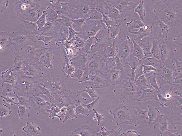 HS578T人乳腺癌细胞（STR鉴定正确）