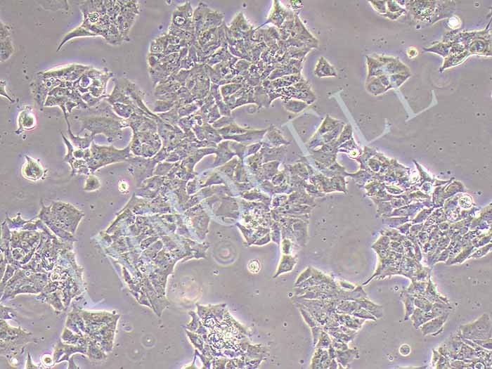 MDA-MB-361人乳腺癌细胞（STR鉴定正确）