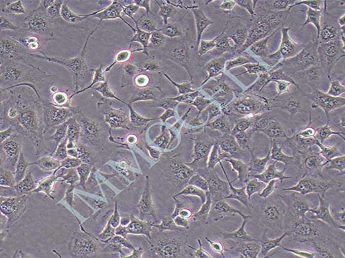 NCI-H1975人肺腺癌细胞（STR鉴定正确）