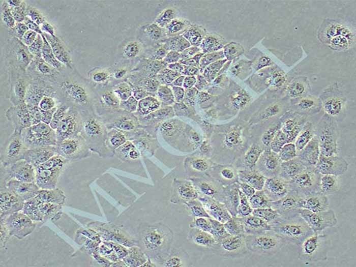 NCI-H292人肺癌细胞(淋巴结转移)（STR鉴定正确）