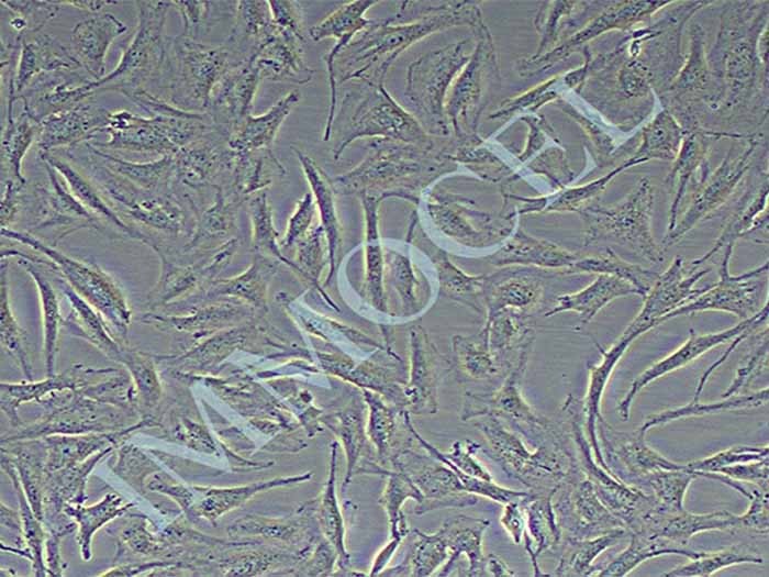 SW579人甲状腺鳞癌细胞（STR鉴定正确）