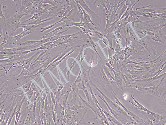 MRC-5人胚肺成纤维细胞（STR鉴定正确）（有限细胞系）