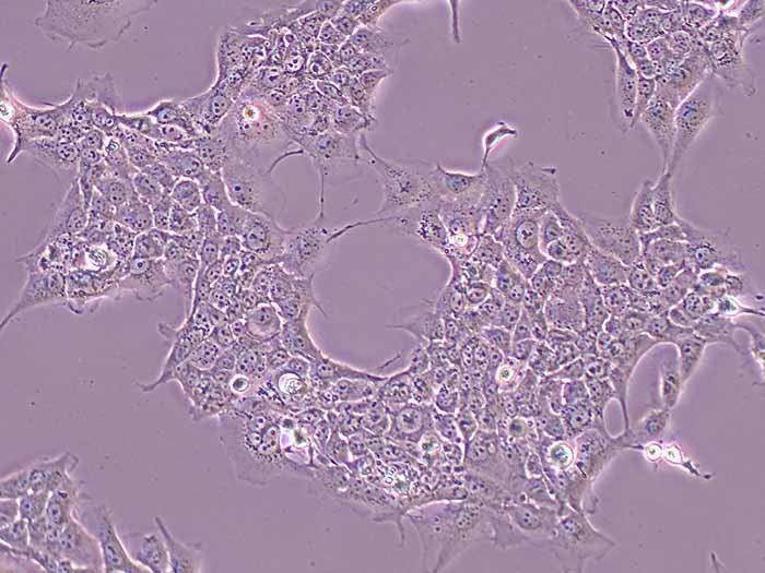 HCC827人非小细胞肺癌细胞（STR鉴定正确）