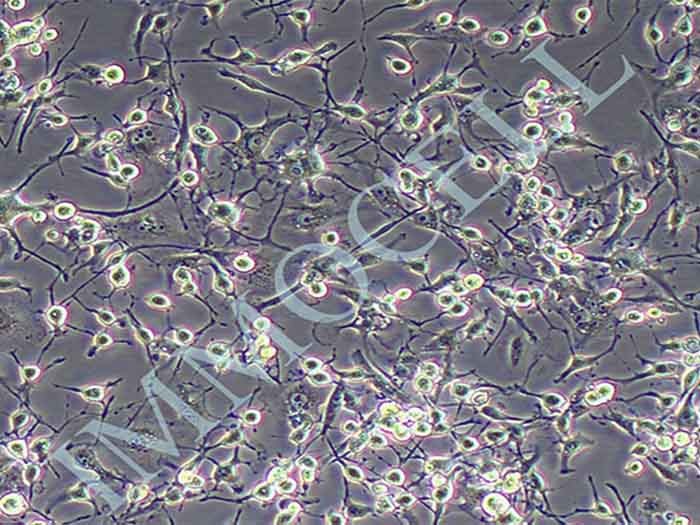 MDA-MB-436人乳腺癌细胞（STR鉴定正确）