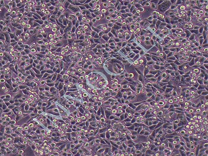 MDA-MB-468人乳腺癌细胞（STR鉴定正确）