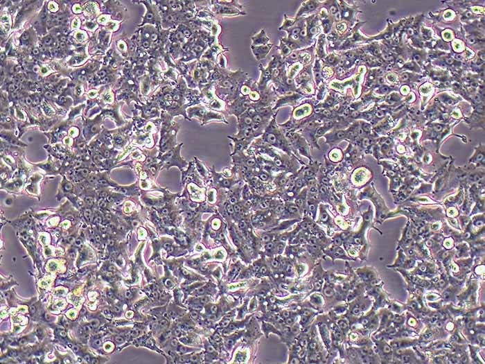 NCI-H1395人肺腺癌细胞（STR鉴定正确）