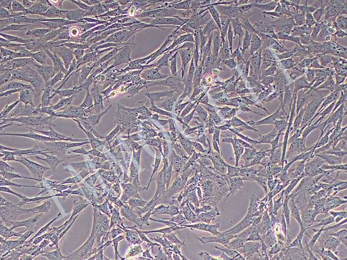 小鼠肺成纤维细胞（永生化）