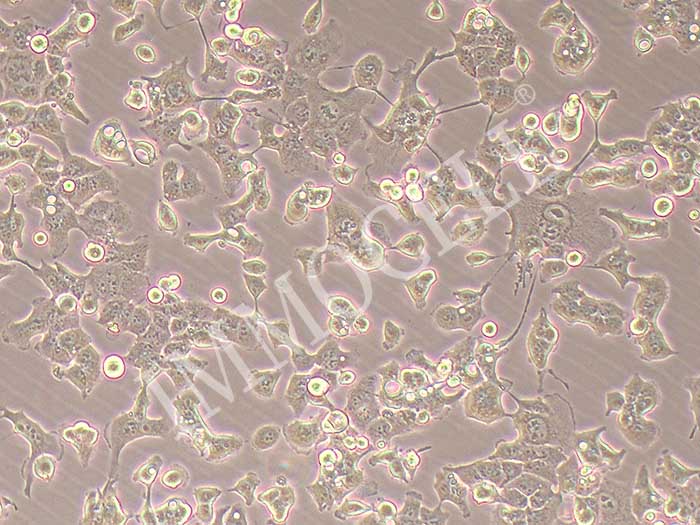 HEC-1-B人子宫内膜腺癌细胞（STR鉴定正确）