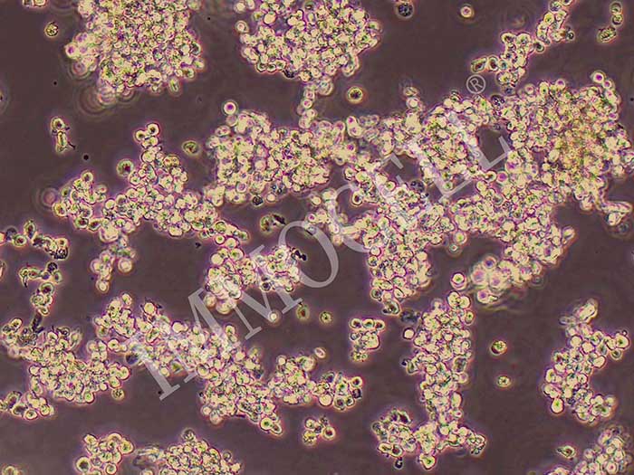 OCI-LY3人弥漫大B细胞淋巴瘤细胞