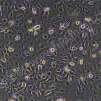 人非小细胞肺癌细胞；NCI-H1650 (STR)