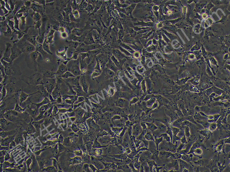 人肝癌细胞；Hep3B2.1-7 (STR)