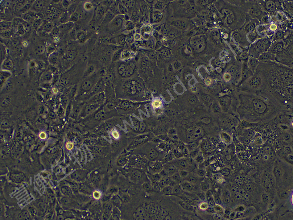 人肺腺癌细胞；NCI-H441  (STR)