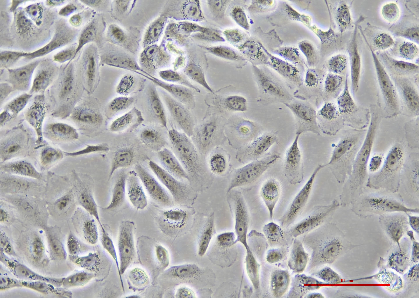 人正常乳腺上皮细胞 MCF 10A（STR鉴定正确）