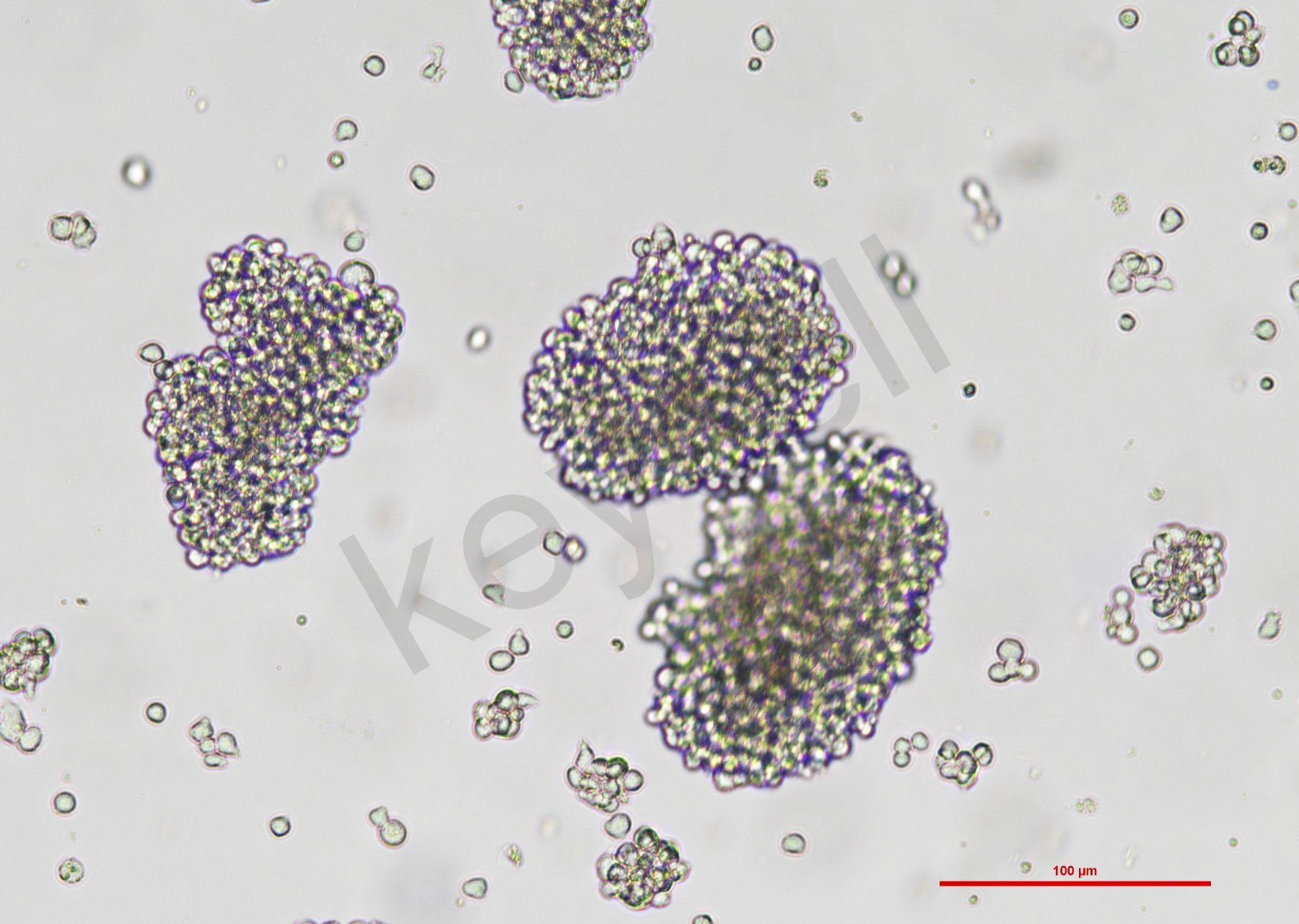 人恶性非霍奇金淋巴瘤患者的自然杀伤细胞 NK-92（STR鉴定正确）