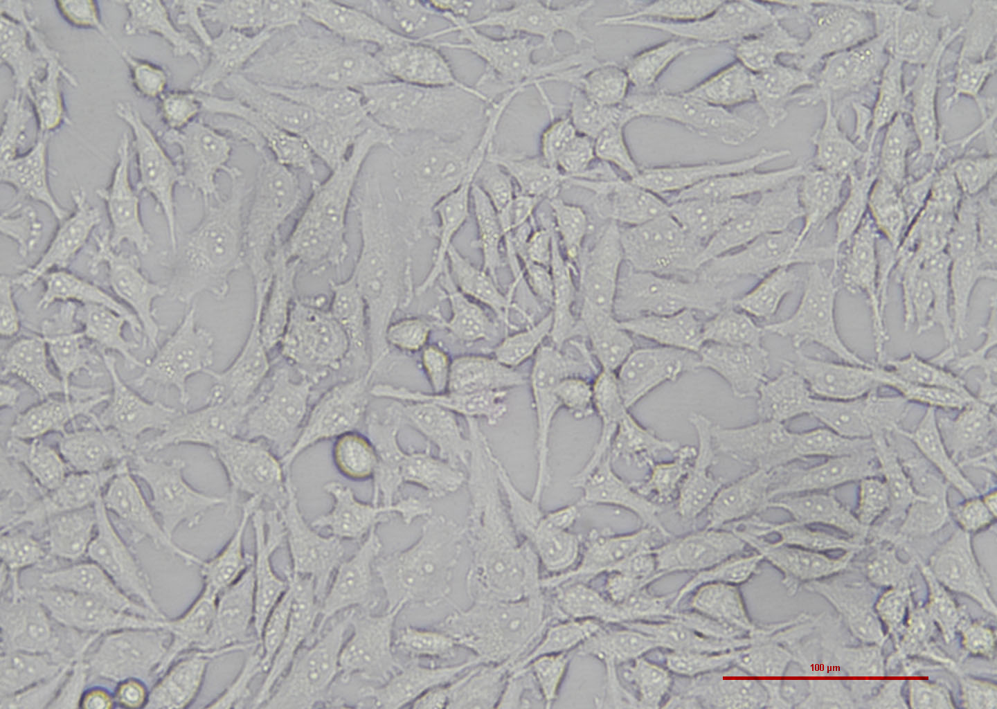 人肝癌细胞 HEPG2（STR鉴定正确）