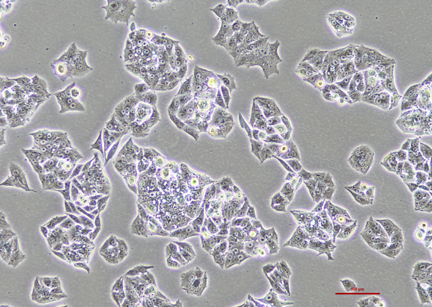 人肺腺癌细胞 NCI-H1395（STR鉴定正确）