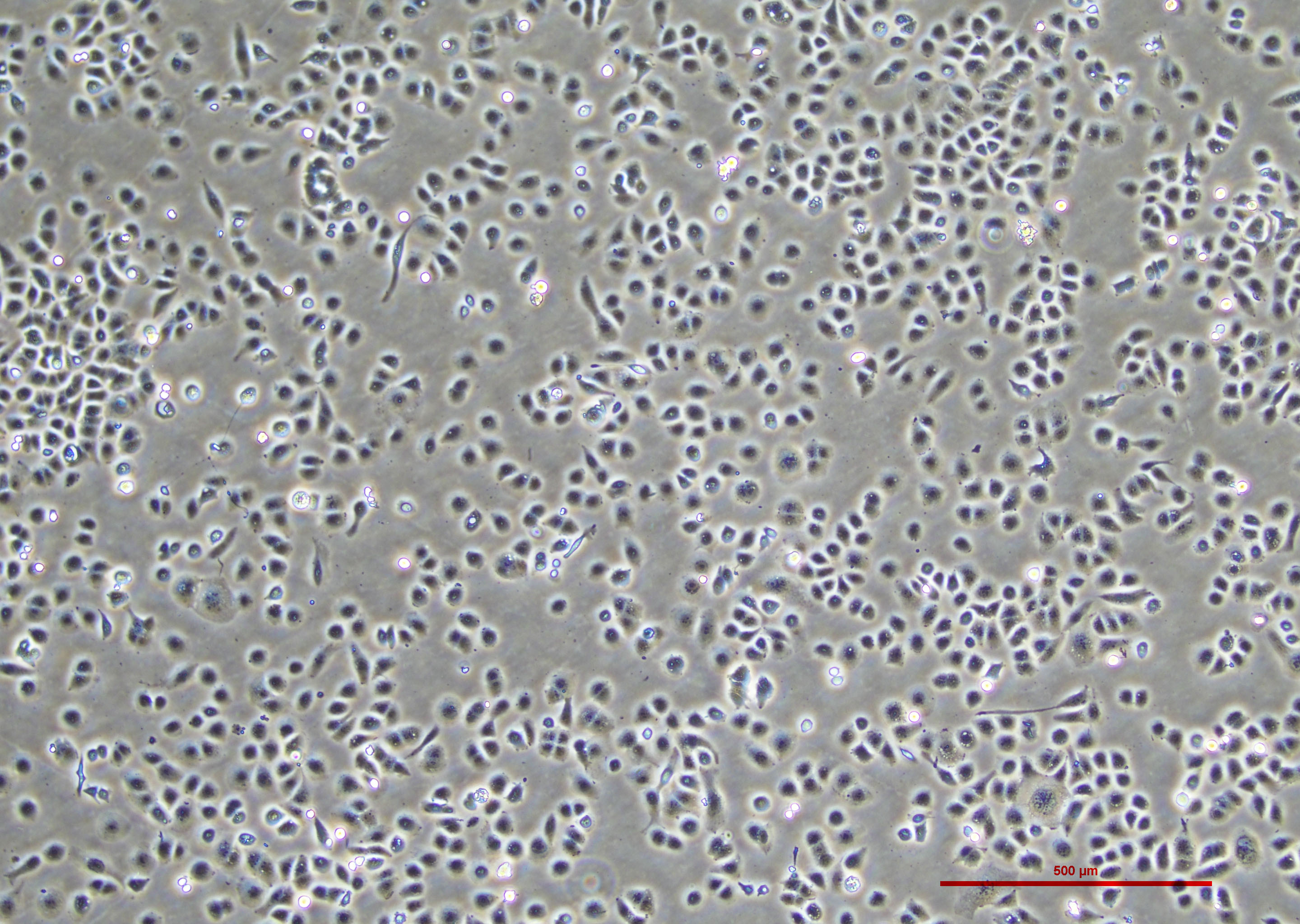 人子宫内膜腺癌细胞 HEC-1-A（STR鉴定正确）