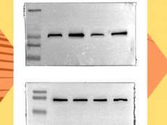 westernblot 下篇 结果分析