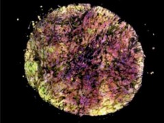 Tissue Cytometry技术为胆管癌相关IL-6信号通路的多组学可视化研究提供策略