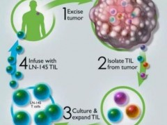 国内TIL细胞疗法竞争格局
