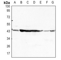 ACTB antibody Catalog Number: orb393034