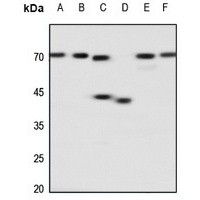 ADORA2A antibody Catalog Number: orb213530