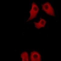 ANXA6 antibody Catalog Number: orb213559