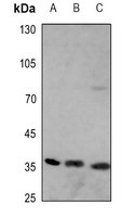 Apolipoprotein E antibody Catalog Number: orb213571