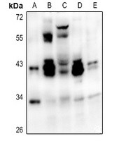 ATF1 antibody Catalog Number: orb213588