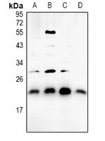 BAX antibody Catalog Number: orb213599