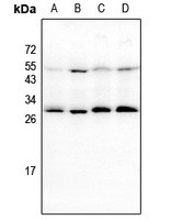 BCL2 antibody Catalog Number: orb213602