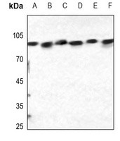 Calnexin (phospho-S583) antibody Catalog Number: orb213636