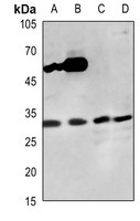 CDK1 antibody Catalog Number: orb213697