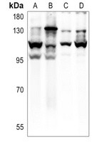 E Cadherin antibody Catalog Number: orb213706