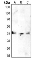 CDK1/2/3 (phospho-T14) antibody Catalog Number: orb213710