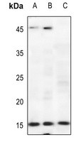 CDKN2B antibody Catalog Number: orb213719