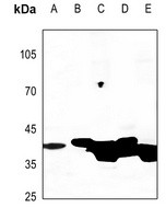 CKM antibody Catalog Number: orb213745