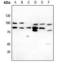 Collagen VI antibody Catalog Number: orb213763