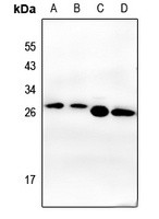 CSNK2B antibody Catalog Number: orb213793