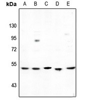 CYP2D6 antibody Catalog Number: orb213825