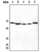 CYP27A1 antibody Catalog Number: orb213835