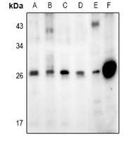 DDIT3 antibody Catalog Number: orb213843