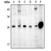 DDIT3 antibody Catalog Number: orb213843