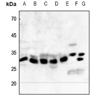 NQO1 antibody Catalog Number: orb213849