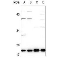 EFNA1 antibody Catalog Number: orb213872