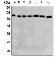 GCLC antibody Catalog Number: orb213983