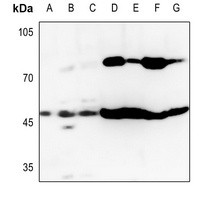 GOT1 antibody Catalog Number: orb213988